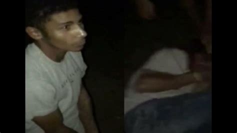 portal zacarias torneira humana|IMAGENS FORTES! JOVEM FICA COM ROSTO .